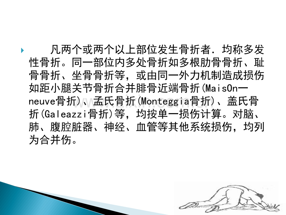 多发性骨折.ppt_第2页