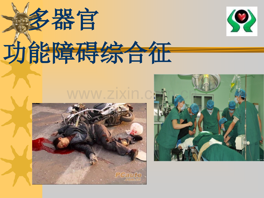 -MODS病人的护理(可编辑修改).ppt_第1页