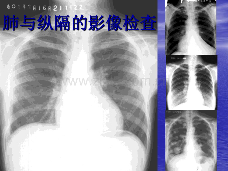 学看胸片.pdf_第1页
