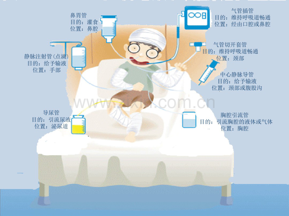 导管的固定与维护-(2).pdf_第2页