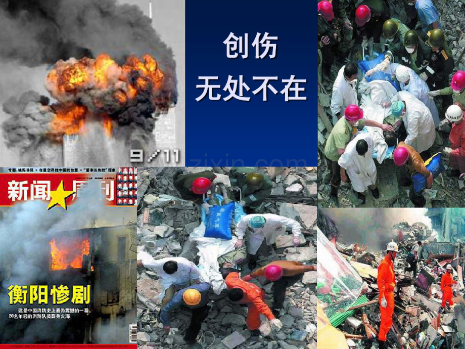 急性创伤的急救、评分标准20090520.pdf_第2页