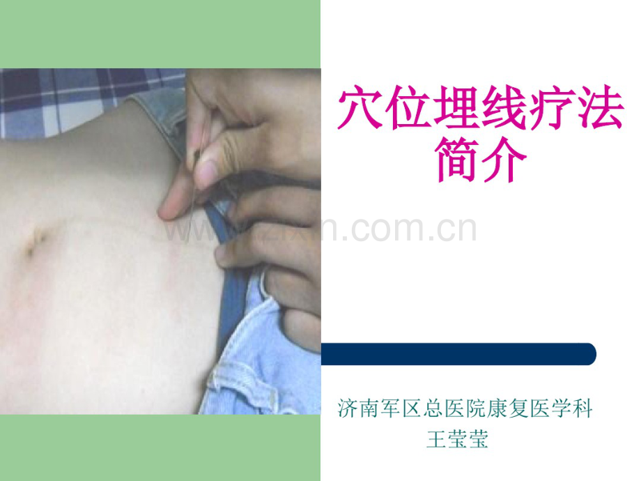 穴位埋线疗法.pdf_第1页