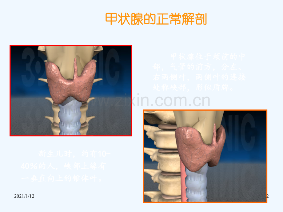 甲状腺结节的超声诊断与鉴别.ppt_第2页