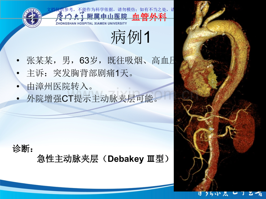 主动脉壁间血肿和穿透性溃疡课件.ppt_第1页