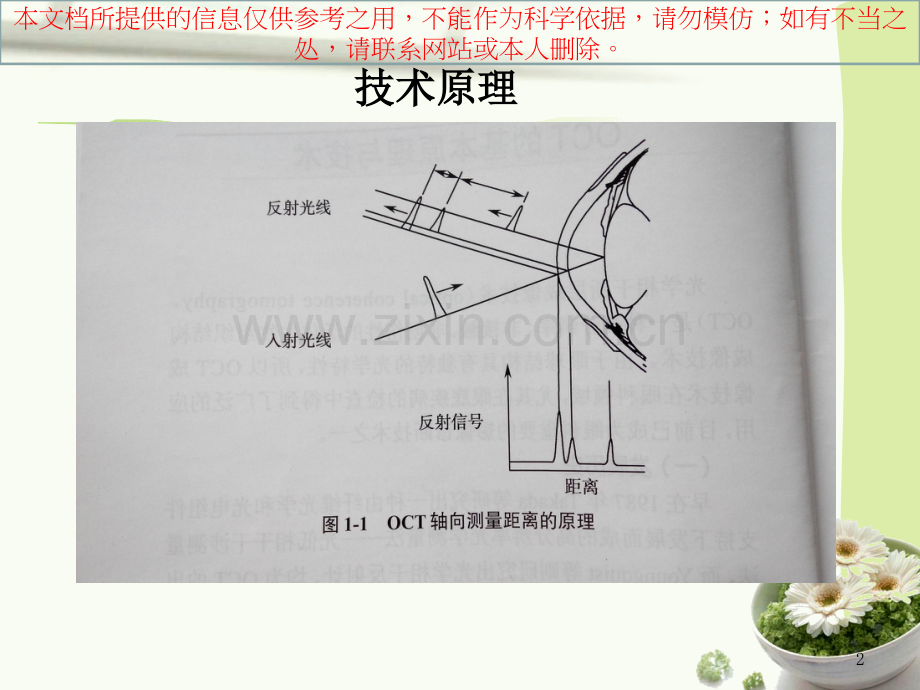 OCT基础知识医疗培训课件.ppt_第2页