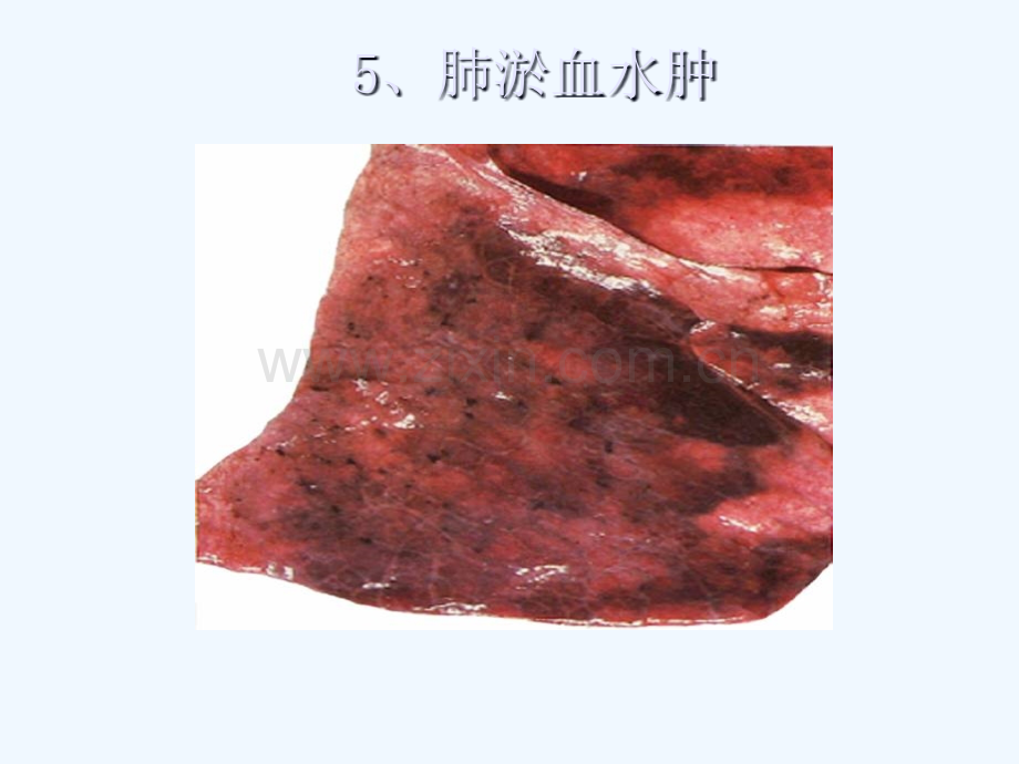 病理学图谱-实验二局部血液循环障碍.pptx_第2页