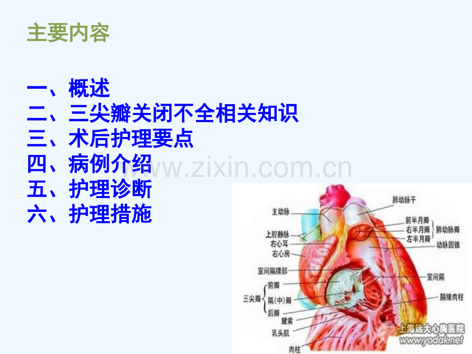 胸腔镜三尖瓣置换术后护理查房.pptx_第2页
