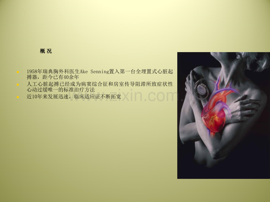 二心脏起搏治疗及护理.ppt_第2页