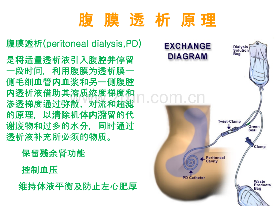 PPT医学课件腹膜透析基本操作技术专题讲座讲义.ppt_第1页