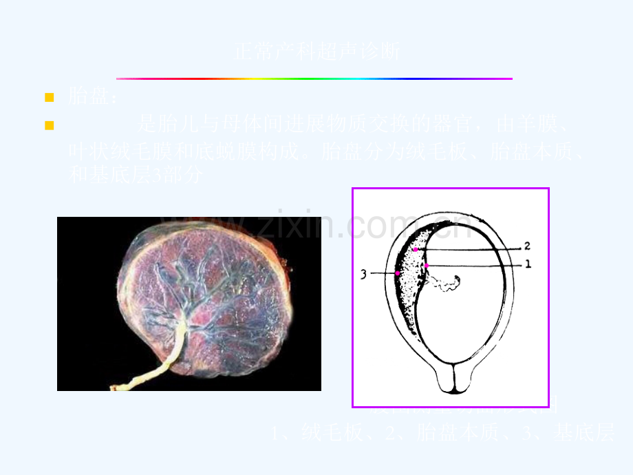 产科急诊超声诊断.ppt_第2页