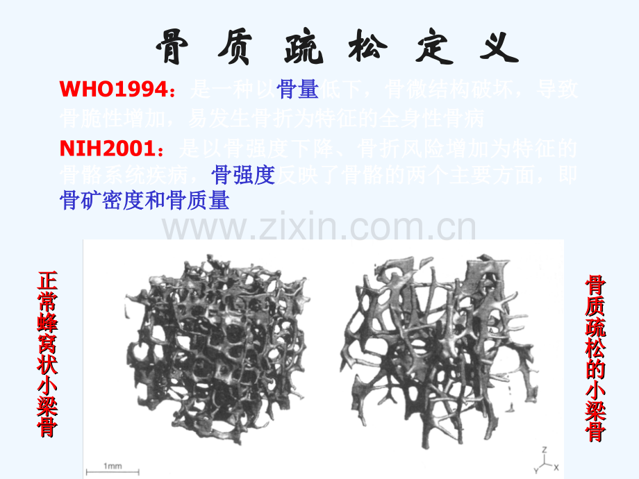 骨质疏松症中西医结合治疗.ppt_第2页