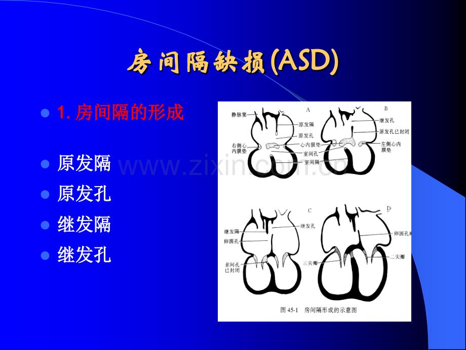 常见先心病的超声诊断.ppt_第2页