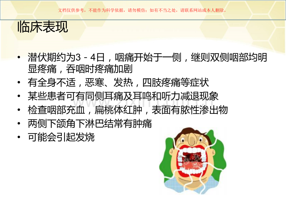 化脓性扁桃体炎课件.ppt_第2页