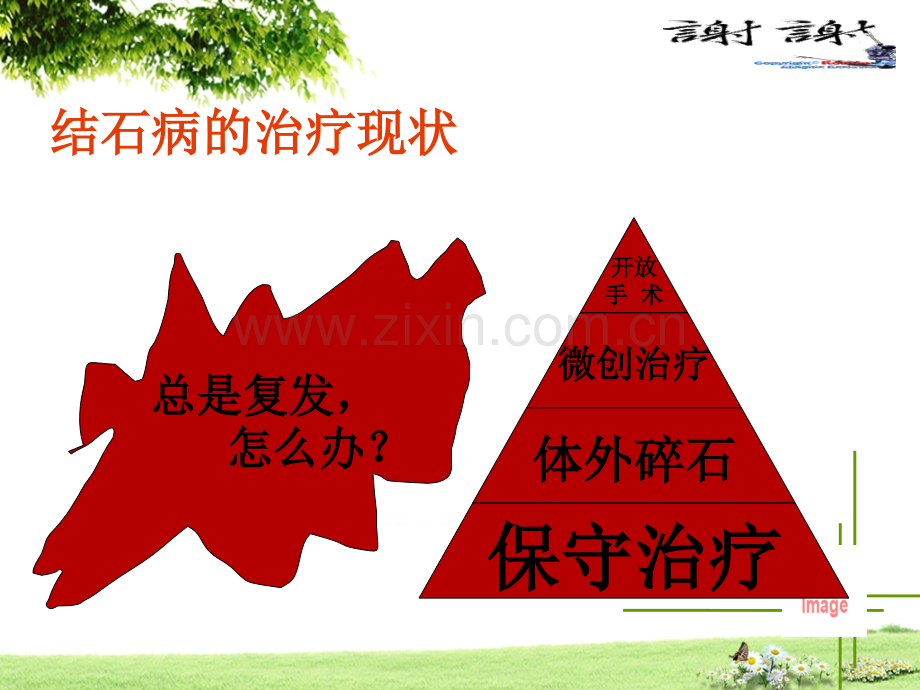 不同成的结石防治-医学课件.ppt_第1页