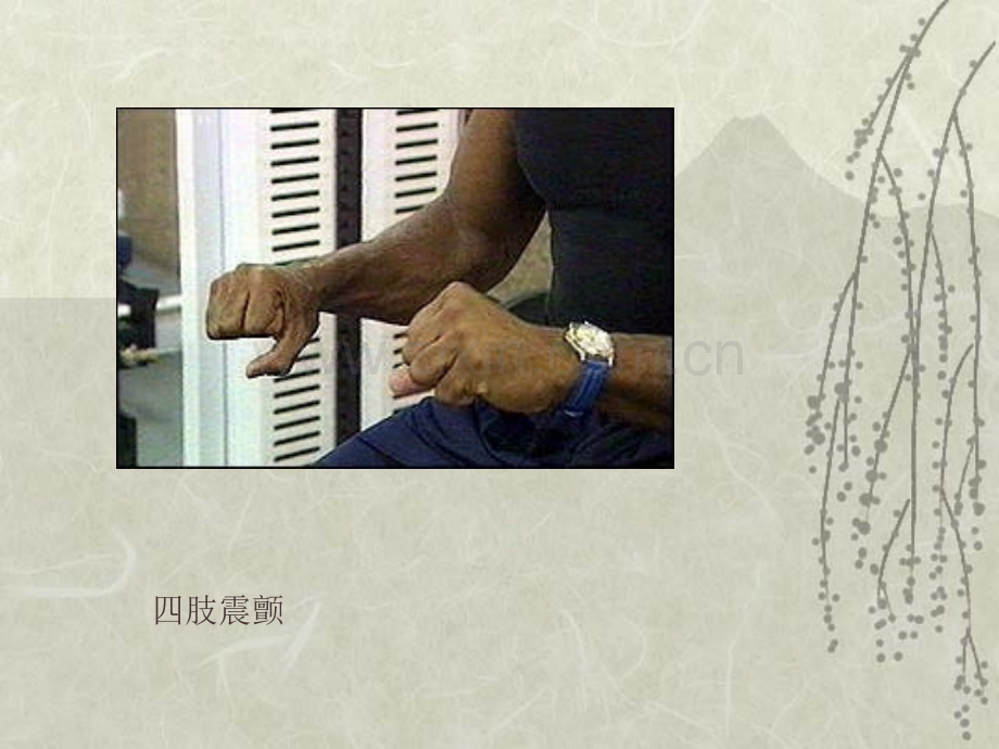 PPT医学课件药理学抗帕金森病药讲义.ppt_第2页
