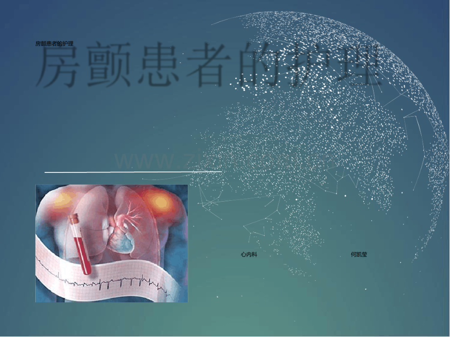 房颤患者护理.ppt_第2页