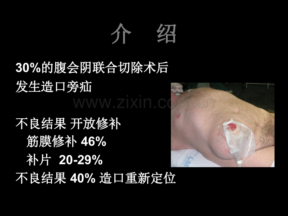 使用IPST补片的腹腔镜造口旁疝修补术.ppt_第2页