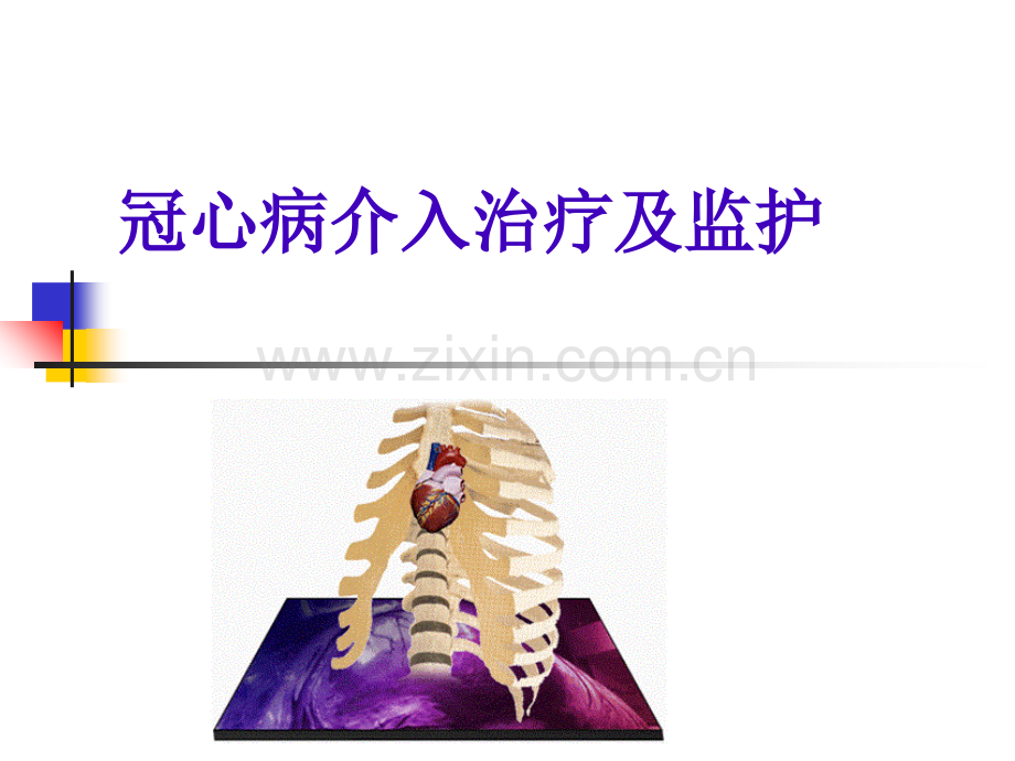 冠心病介入治疗及护理心血管内科.pptx_第1页