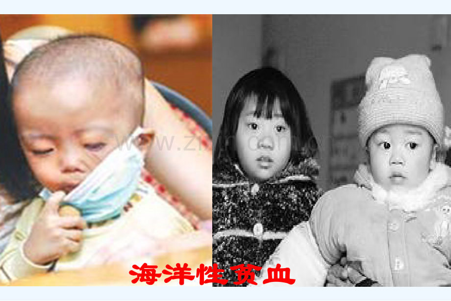 血液内科溶血性贫血概论.pptx_第2页