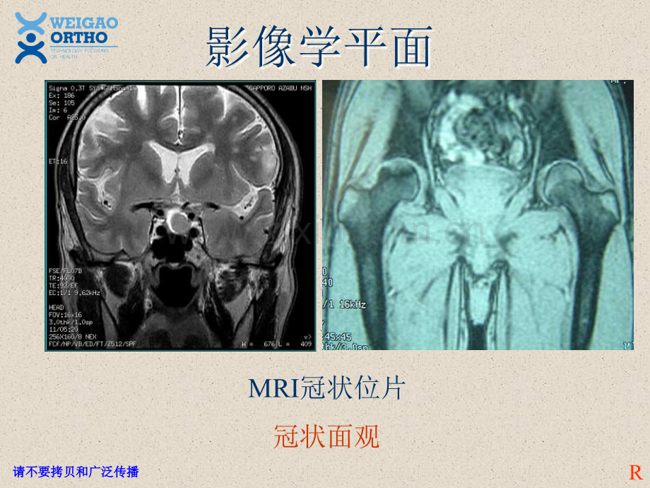PPT医学课件脊柱解剖基础讲义.ppt_第2页