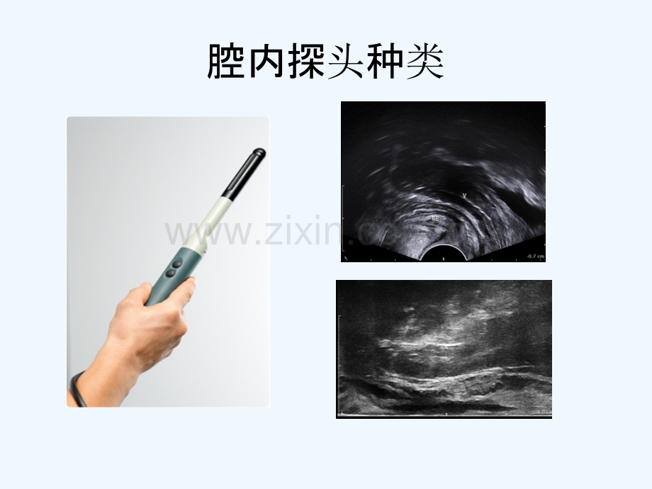 直肠腔内超声临床诊断.pptx_第2页