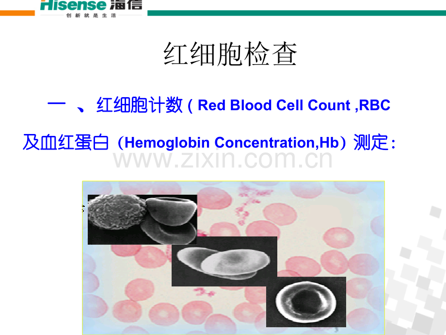 PPT医学课件血常规检查及其意义医生解读讲义.ppt_第2页