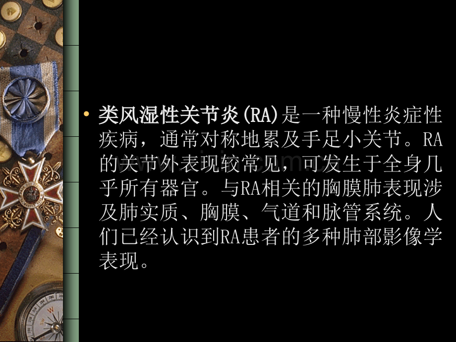 类风湿肺部侵犯影像诊断.ppt_第2页