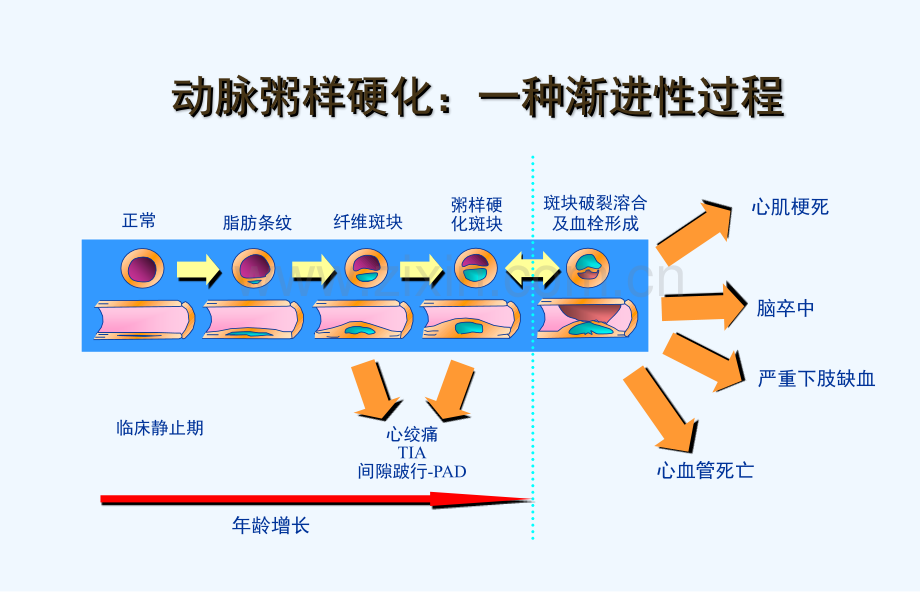 冠心病心绞痛.ppt_第2页
