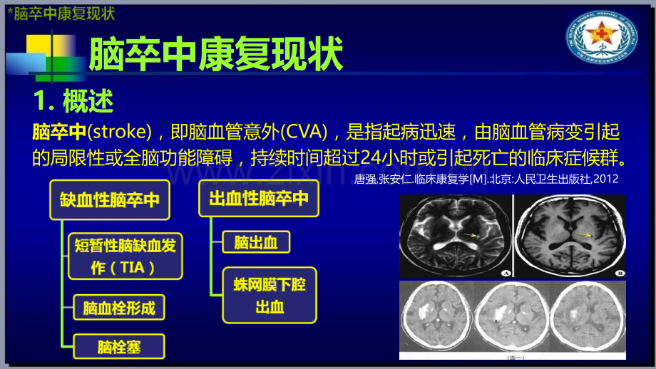 PPT医学课件脑卒中的康复现状与进展讲义.ppt_第2页