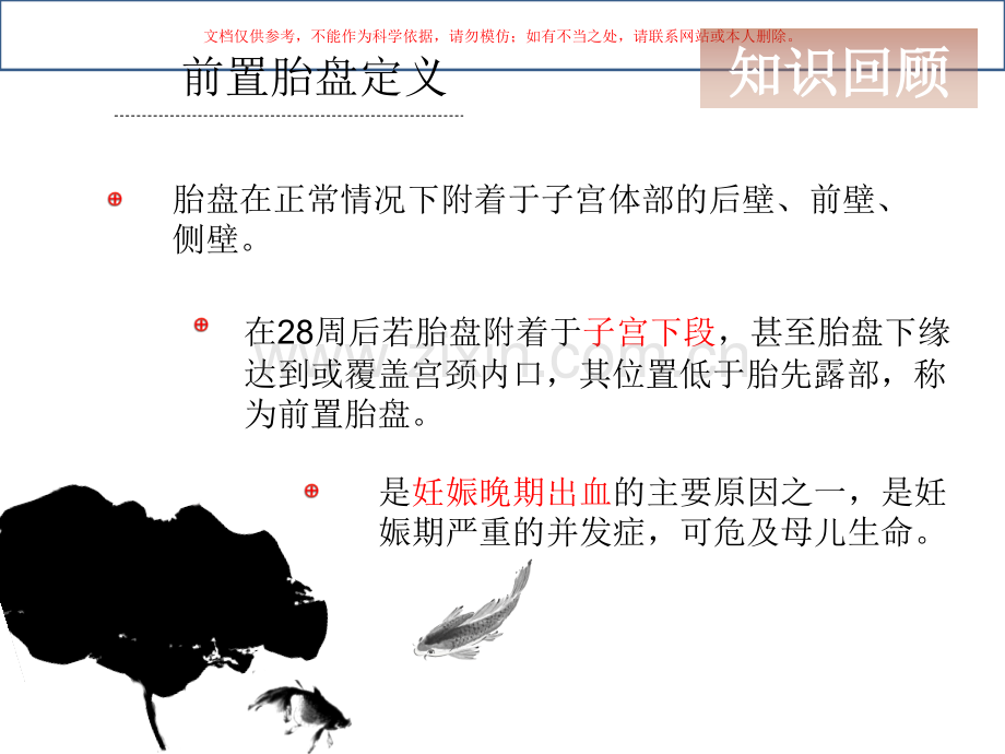 前置胎盘护理查房课件.ppt_第2页
