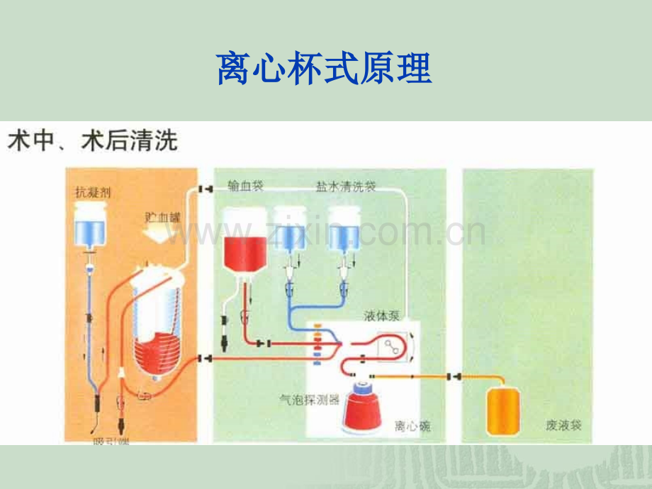 PPT医学课件血液回收禁忌及适应症讲义.ppt_第2页