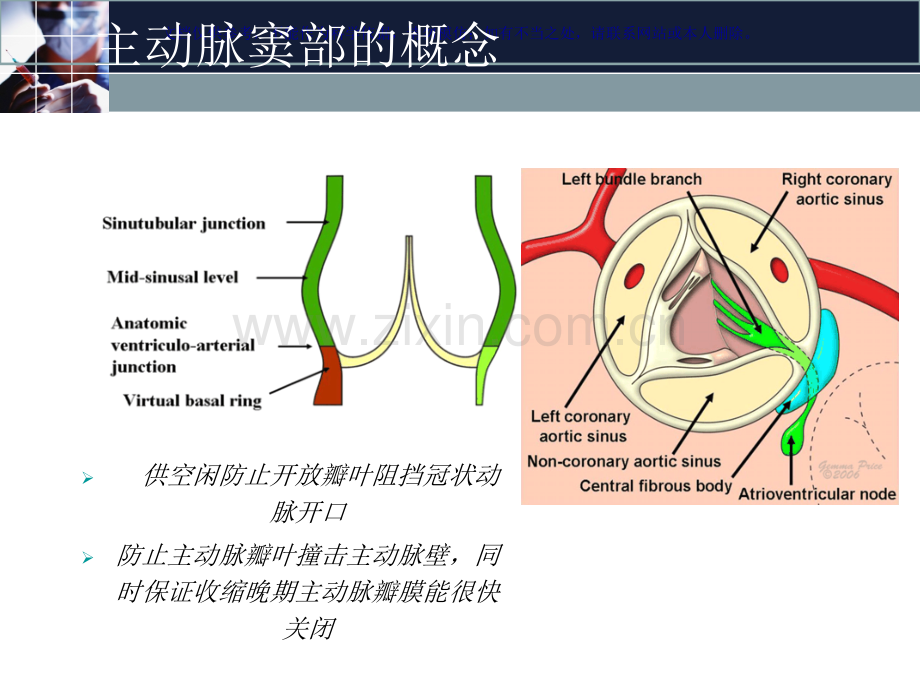主动脉窦动脉瘤Valsalva窦动脉瘤课件.ppt_第2页