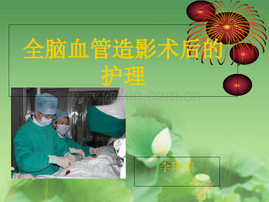 全脑血管造影术后的护理.ppt_第2页