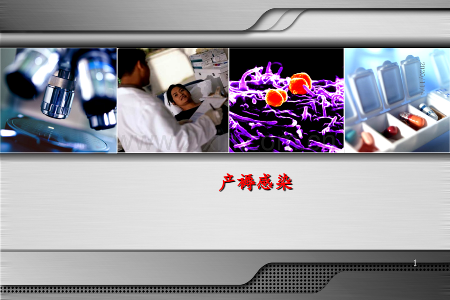 产褥感染课时.ppt_第1页