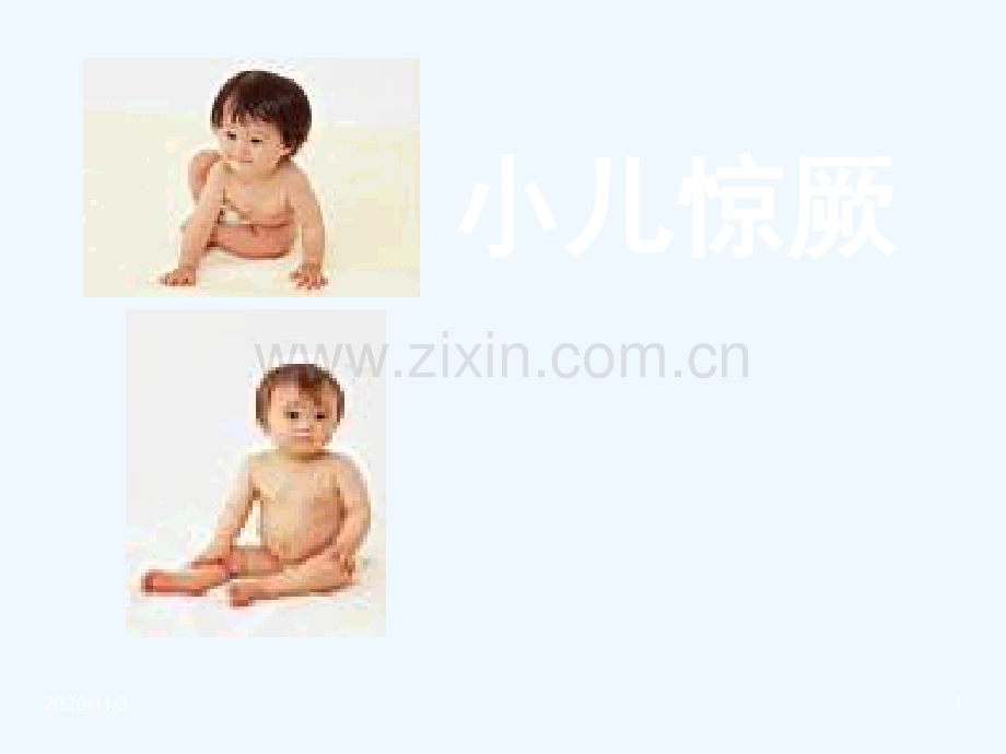 超详细小儿惊厥.ppt_第1页