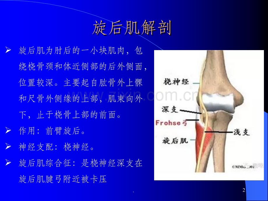 旋后肌综合征.ppt_第2页