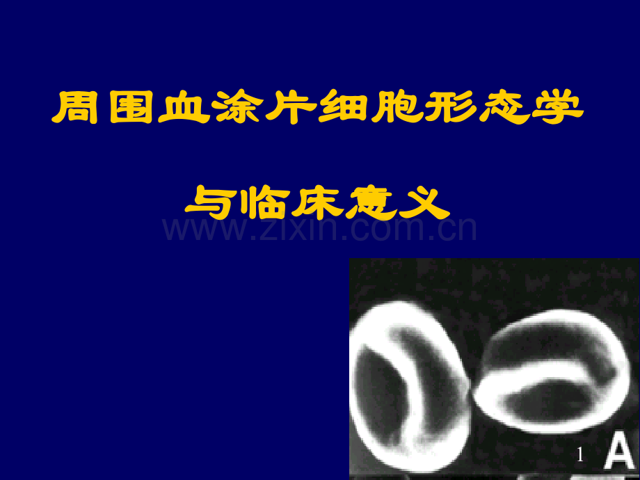周围血涂片形态和临床意义可编辑版.ppt_第1页