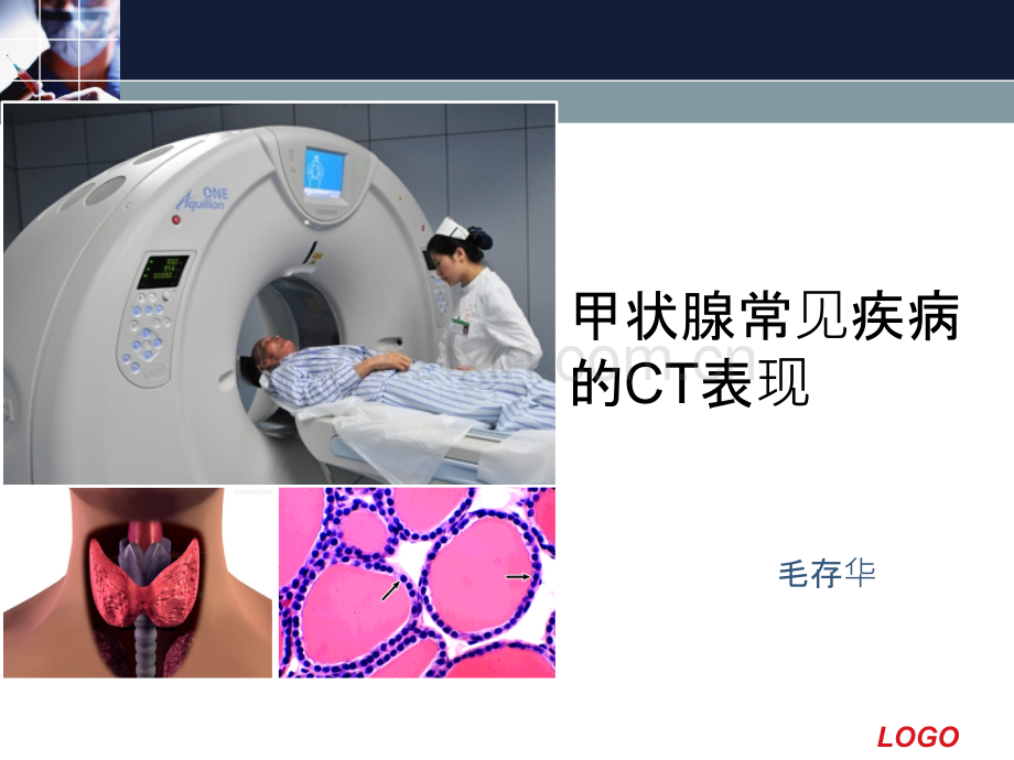 甲状腺常见疾病的CT表现.ppt_第1页