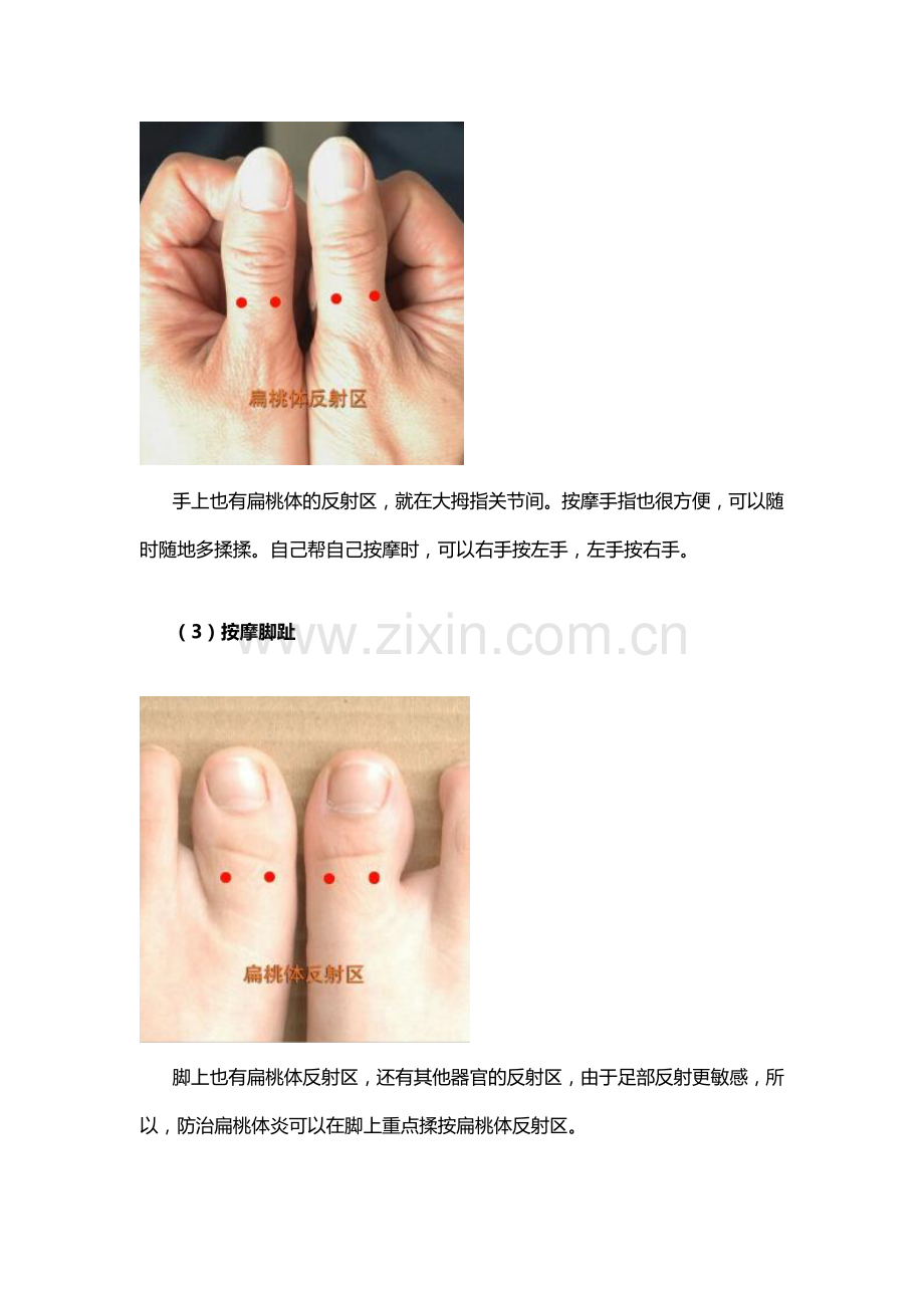 巧治扁桃体发炎.doc_第2页
