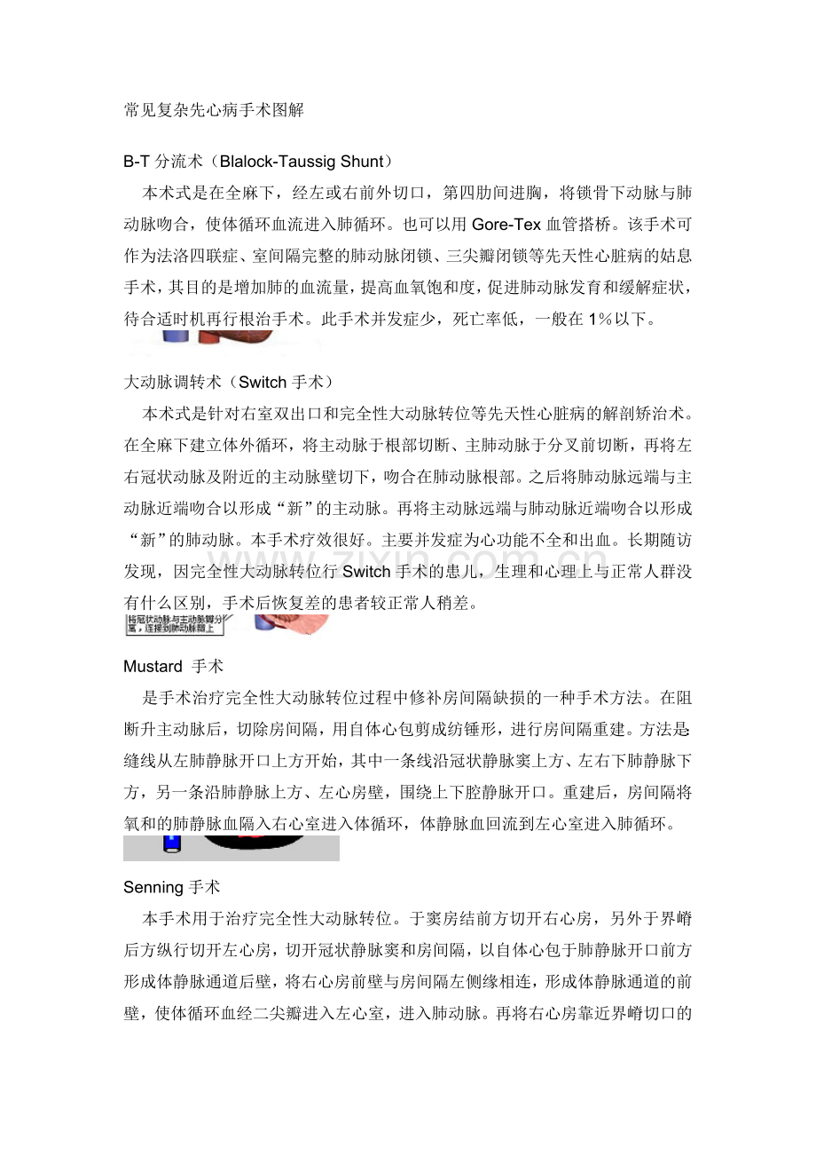 常见复杂先心病手术图解.doc_第1页
