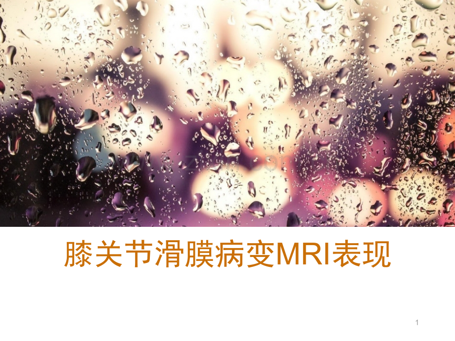 膝关节滑膜病变MRI表现.ppt_第1页