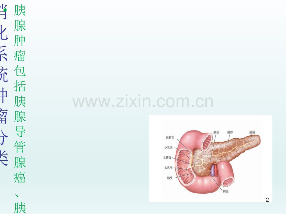 胰腺肿瘤分类及诊疗.ppt_第2页