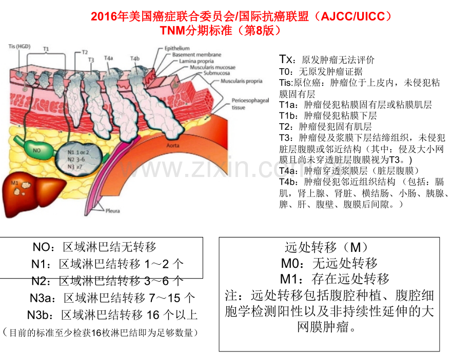 胃癌分期.ppt_第2页