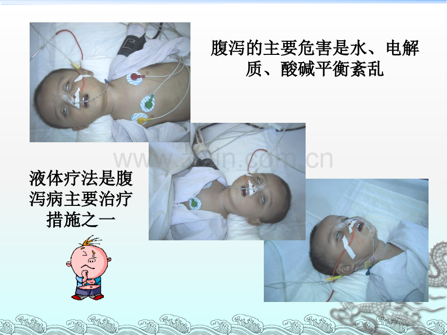 小儿腹泻液体疗法.ppt_第2页