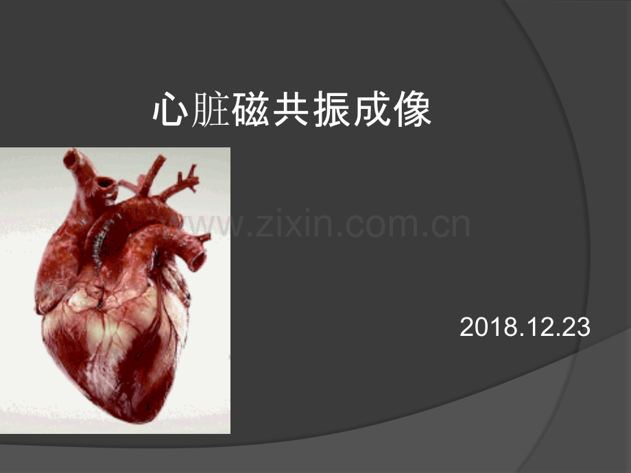 心脏磁共振成像).ppt_第1页