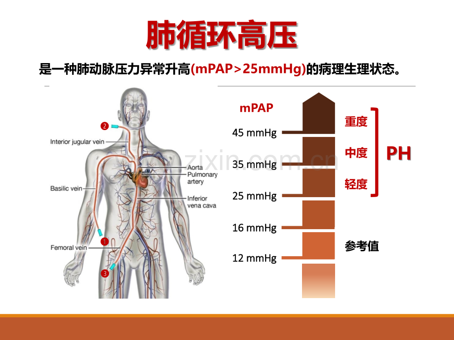肺血管舒张试验.ppt_第2页
