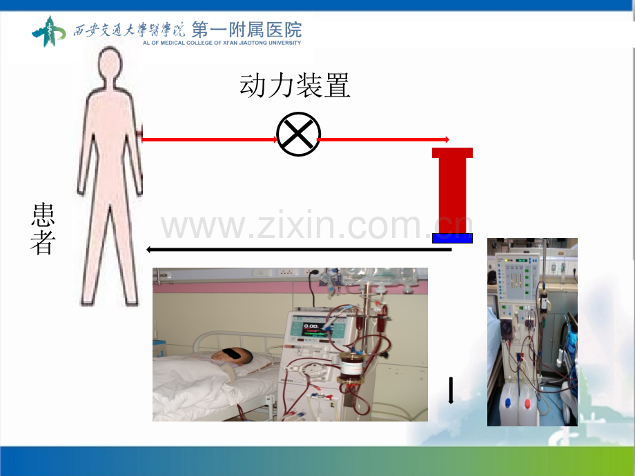 血液灌流操作流程.ppt_第2页