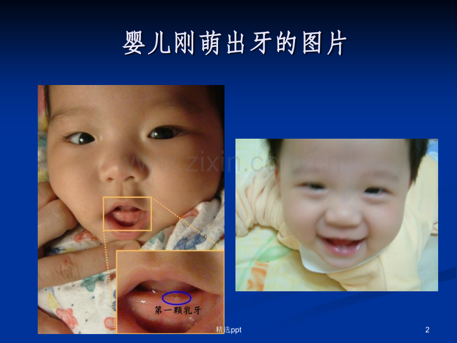 牙齿的发育过程.ppt_第2页