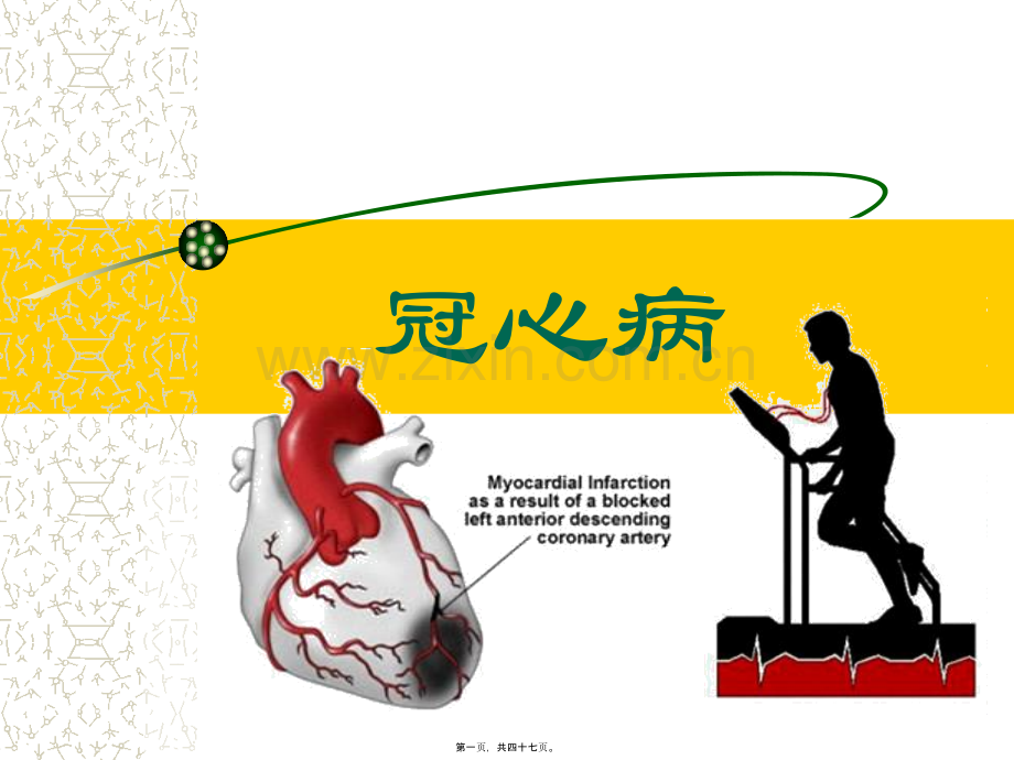 第六节-冠心病.ppt_第1页