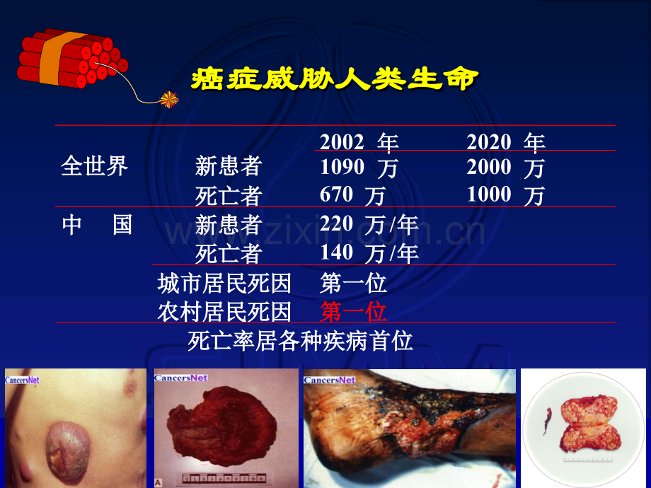 实现肿瘤化疗个体化的思考(医学PPT课件).ppt_第2页